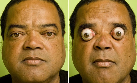   1. Sunkiausias krovinys tempiamas akimis Tikėkite arba ne, bet šis vyras 2009 metais savo akių duobutėmis patempė 411 kg […]